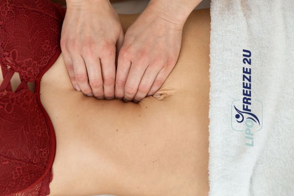 diastasis recti treatment Weston Super Mare