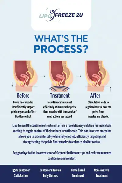 Diagram of how incontinence treatment Weston Super Mare works.