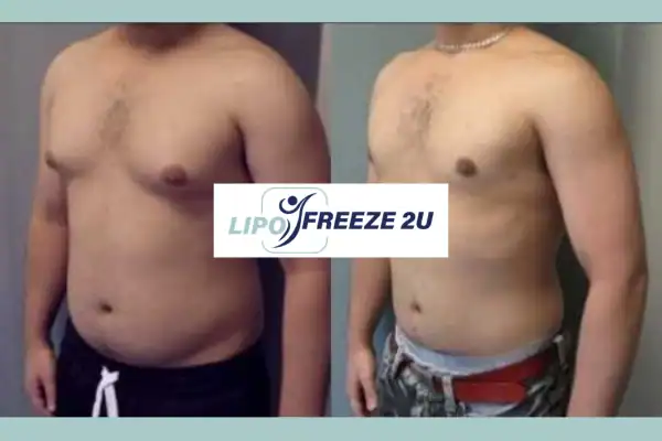 How Long Does It Take to See Results Weston Super Mare?