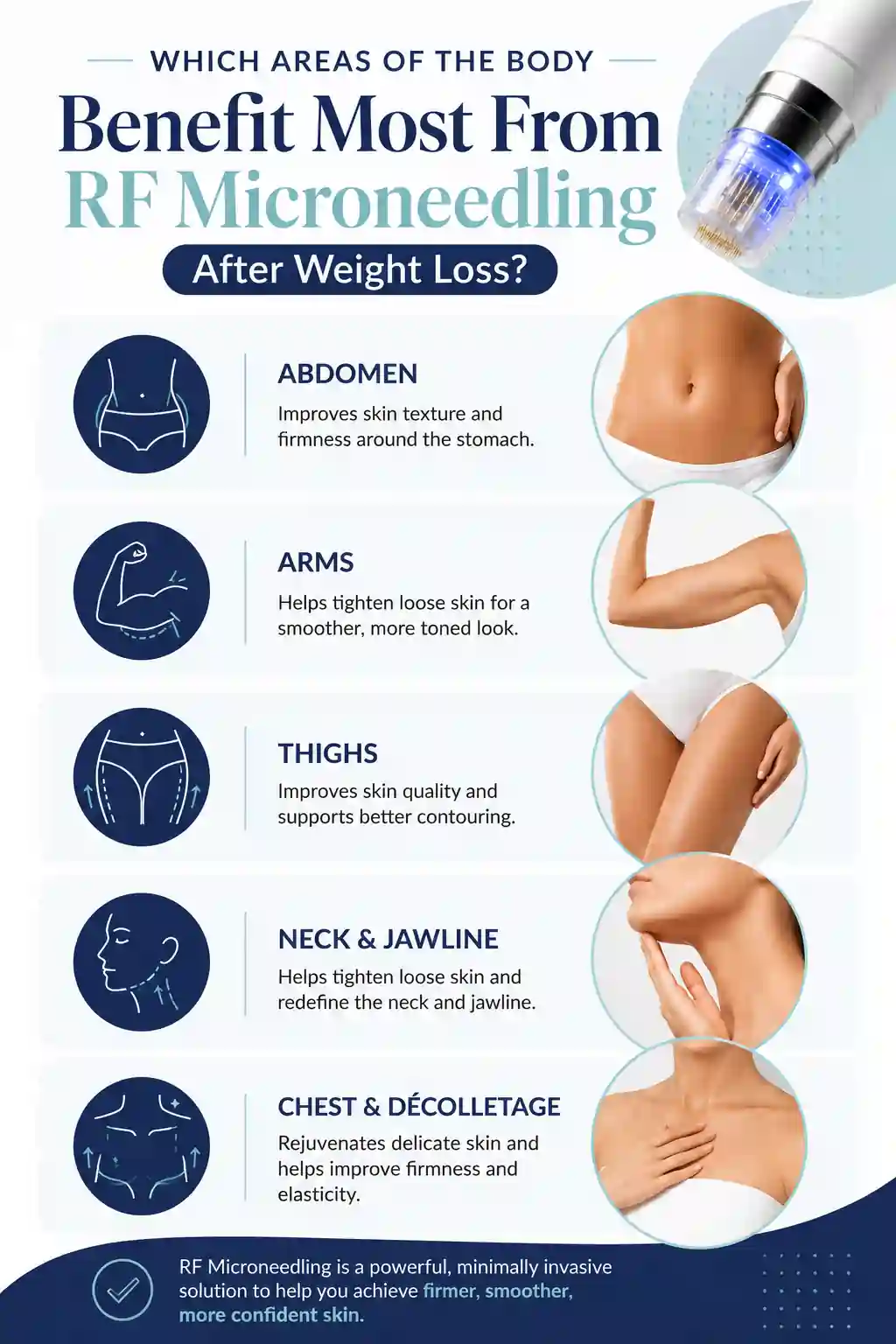 Which Areas of the Body Benefit Most From RF Microneedling After Weight Loss Weston Super Mare